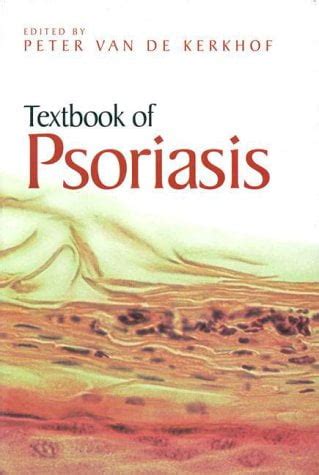 Textbook of psoriasis hardcover 2003 by peter c m van de kerkhofeditor. - Permanently beat pcos the complete solution proven step by step polycystic ovarian syndrome guide to improved.