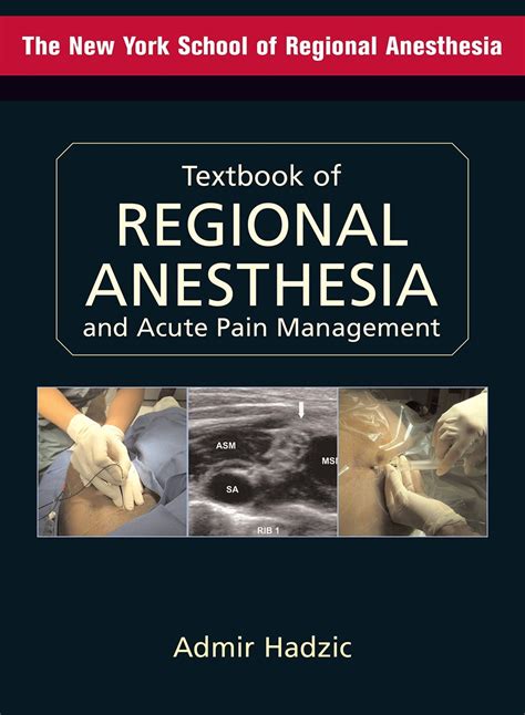 Textbook of regional anesthesia and acute pain management hadzic textbook. - Sonata for harp and bicycle study guide.