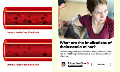 Thalassemia Is A Blood Disorder That Affects 5% of Singapore