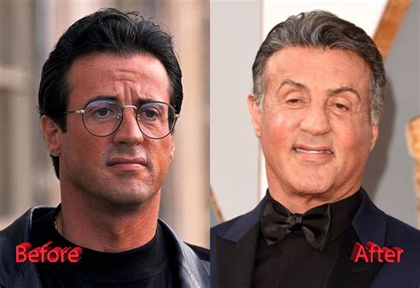 The Before And After Of Sylvester Stallone