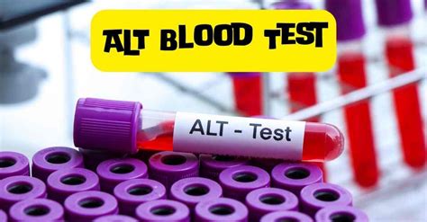 The Comprehensive Guide To ALT Blood Test by Marvel Path Lab Jun