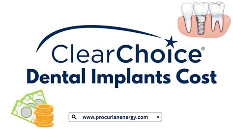 The Cost of Dental Implants ClearChoice Dental Implant Centers