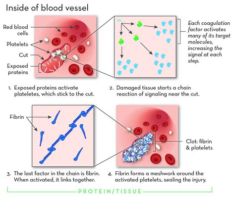 The Effects of Hemophilia on Socialization Blood American …