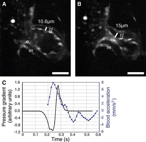 The Embryonic Vertebrate Heart Tube Is a Dynamic Suction Pump