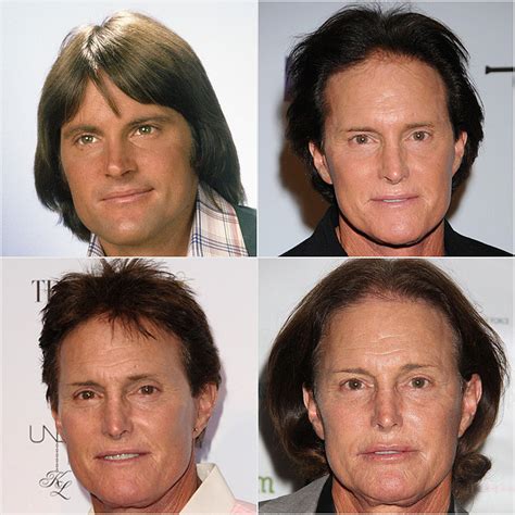 The Evolution of Bruce Jenner