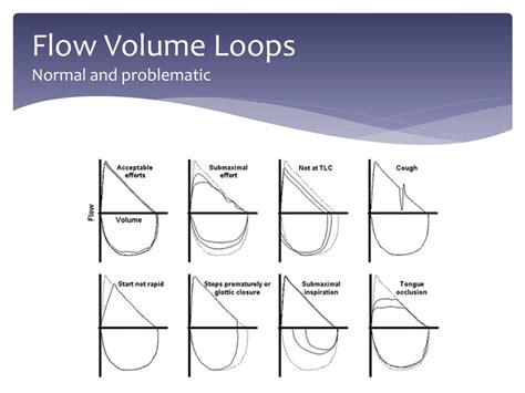 The Flow Volume Loop: Normal Standards and Abnormalities in …