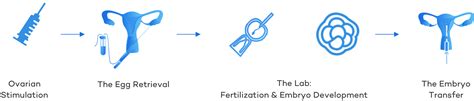 The IVF Process Everything You Need to Know CNY Fertility