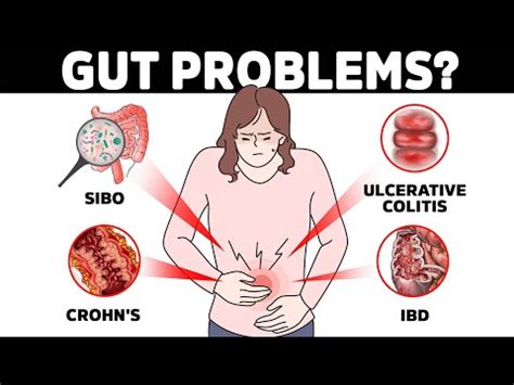 The Quickest Way to Test for Bowel Disease (Crohn