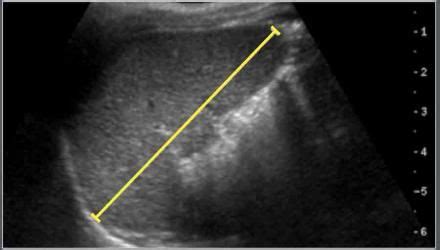 The Radiology Assistant : Ultrasound