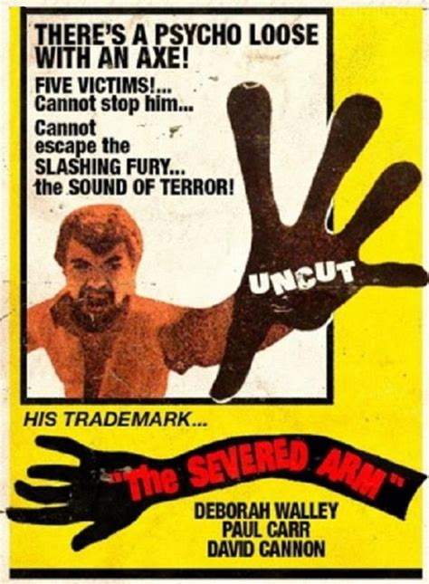 The Severed Arm
