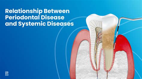 The Tricky Relationship Between Gum Disease & Dental Implants