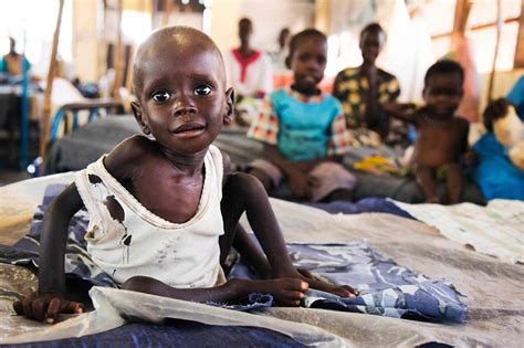 The UN food agency says that 1 in 5 children who arrive in South Sudan from Sudan are malnourished