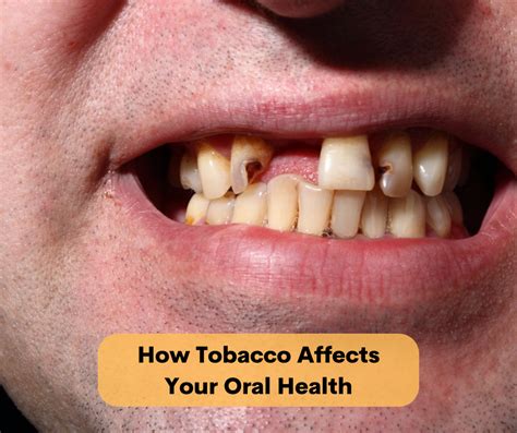 The Ultimate Guide to Fiberglass Chewing Tobacco: Revolutionizing Your Oral Health Routine