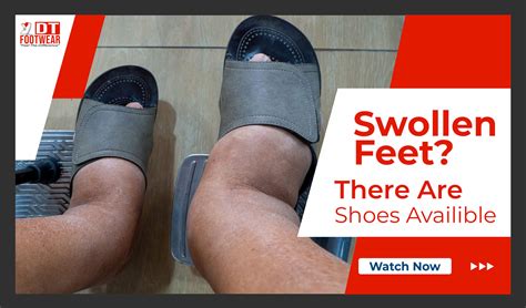 The Ultimate Guide to Preventing and Relieving Sneakers Swollen Feet