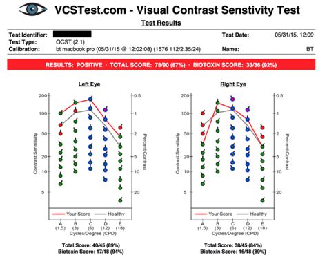 The Visual Contrast Sensitivity Test Exploring A New Mold Exposure Test