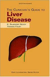 The clinicians guide to liver disease the clinicians guide to gi series. - Networking for people who hate networking a field guide for introverts the overwhelmed and the und.
