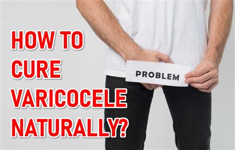 The complete guide to natural healing of varicocele varicocele natural treatment without surgery. - Helmut jacoby meister der architekturzeichnung master of architectural drawings.
