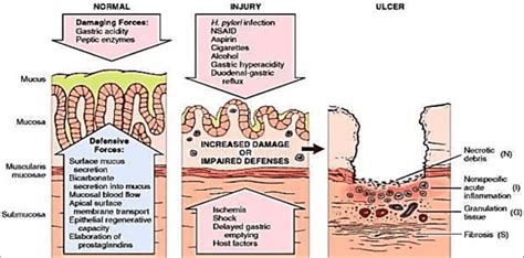 The corticovisceral theory of the pathogenesis of peptic ulcer by. - Facebook 101 for business your complete guide.