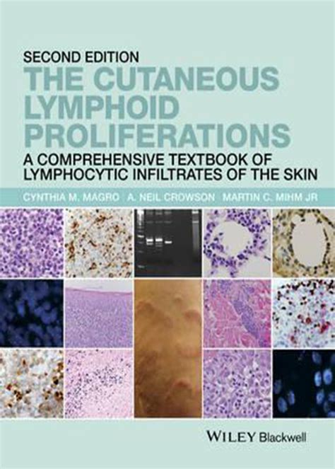 The cutaneous lymphoid proliferations a comprehensive textbook of lymphocytic infiltrates of the ski. - Your tax credits guide avoid overpayments and underpayments.