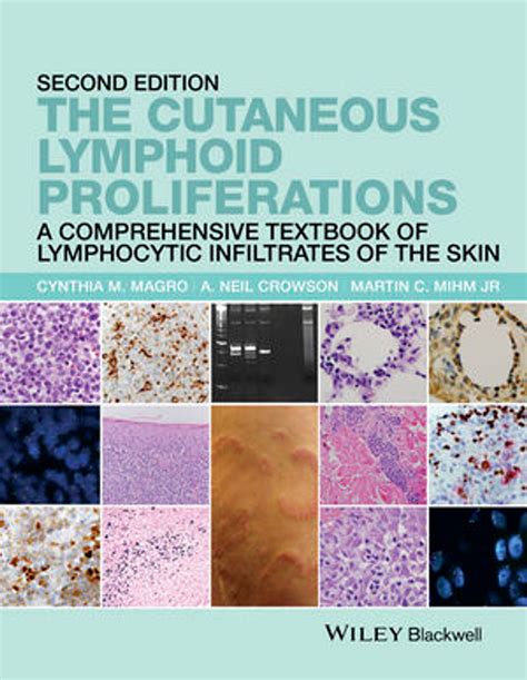 The cutaneous lymphoid proliferations a comprehensive textbook of lymphocytic infiltrates of the skin. - Hp photosmart premium fax all in one printer series c309 manual.
