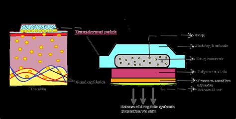 The development of transdermal patches