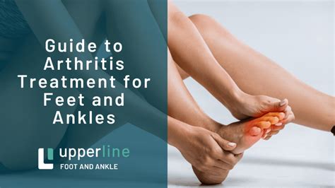 The foot and ankle in rheumatoid arthritis a comprehensive guide. - Om erstatning for liv: et bidrag til læren om skadeserstatning.