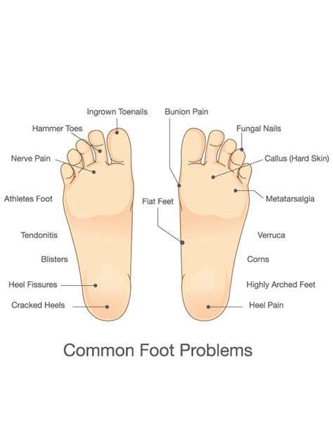 The footbook a guide to podiatric care podiatry information library. - Turf pro riding lawn mower manuals.