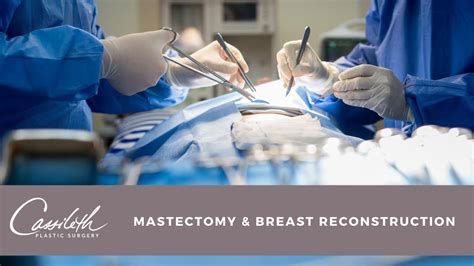 The guide to breast reconstruction step by step from mastectomy. - Theoretisch en practisch molenboek voor ingenieurs, aannemers, molenmakers en verdere bouwkundigen.