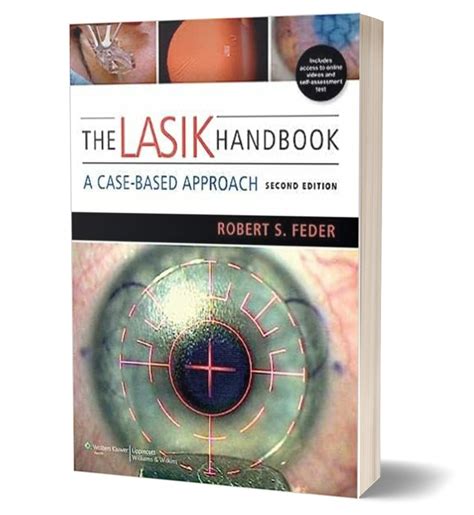 The lasik handbook a case based approach by feder md robert s 2013 paperback. - Mcculloch chainsaw repair manual model 60012312.