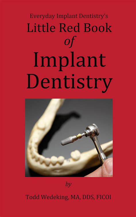 The little red book of implant dentistry everyday implant dentistrys little red guides 1. - Cmos battery removal guide aspire 1670.