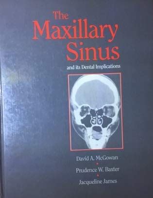 The maxillary sinus and its dental implications dental practical handbooks. - Club car ds s repair manual.
