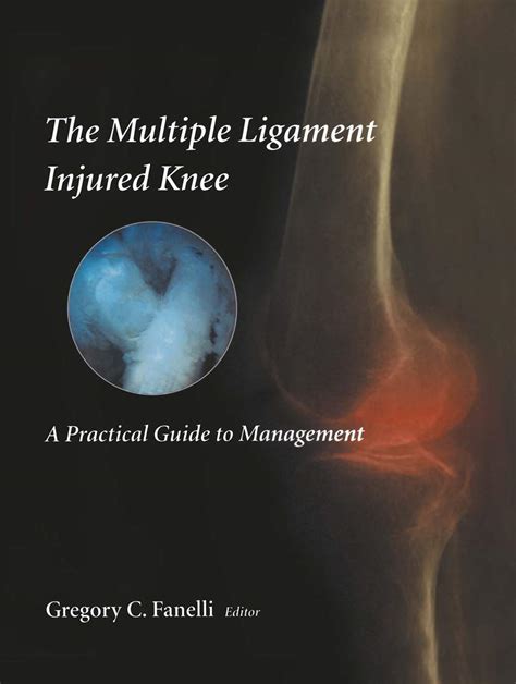The multiple ligament injured knee a practical guide to management. - Gesänge aus die goldgrotte des geisterbanners, oder, noch einmal jung.