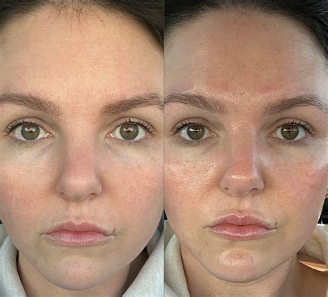 The only facial. THE ONLY FACIAL - 11 Photos - 1175 Colonnade Ctr, St. Louis, Missouri - Acne Treatment - Phone Number - Yelp. The Only Facial. 5.0 (9 reviews) Claimed. Acne Treatment, … 