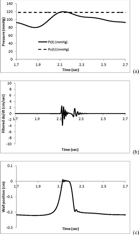 The origin of Korotkoff sounds and the accuracy of ... - PubMed