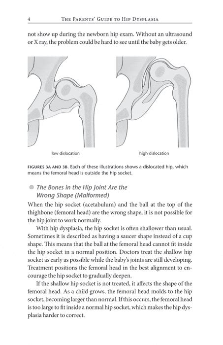 The parents guide to hip dysplasia. - Journey across time study guide for.