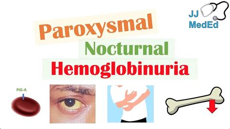 The prothrombotic state in paroxysmal nocturnal hemoglobinuria: …