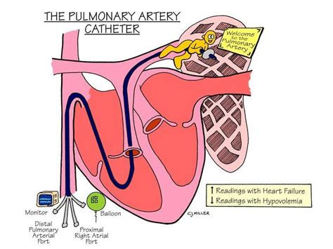 The pulmonary artery catheter in critical care a concise handbook. - Mini excavator mm40sr mitsubishi service manual.