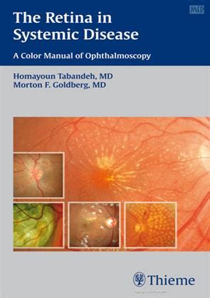 The retina in systemic disease a color manual of ophthalmoscopy 1st edition. - 2013 vw jetta tdi highline owners manual.