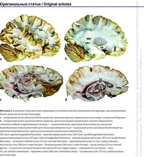 The role of white matter dissection technique in modern …