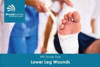 The technology WoundExpress to manage lower leg wounds