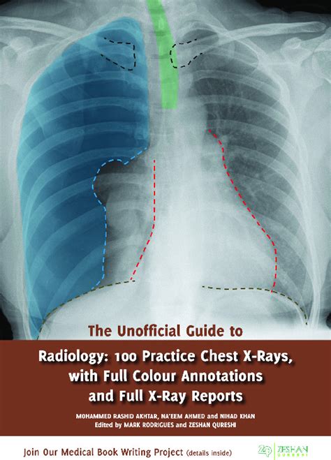 The unofficial guide to radiology 100 practice chest x rays. - Polacy w ruchu oporu na zachodzie..