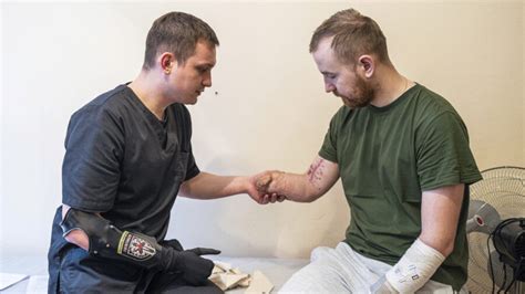 The war in Ukraine took away their limbs. Now bionic prostheses empower wounded soldiers