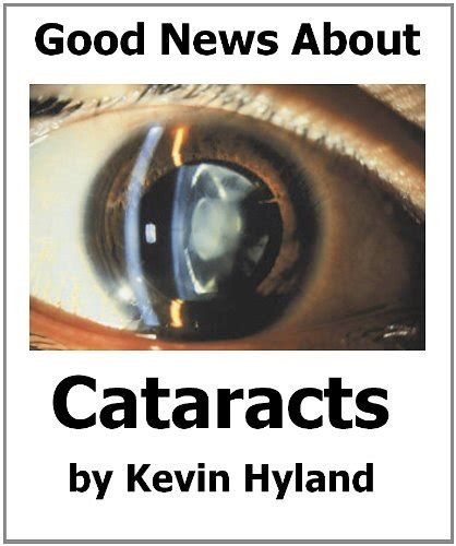 Full Download The Good News About Cataracts By Kevin Hyland