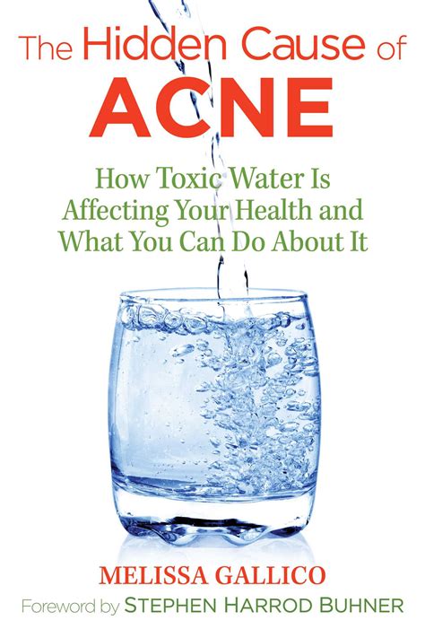 Full Download The Hidden Cause Of Acne How Toxic Water Is Affecting Your Health And What You Can Do About It By Melissa Gallico