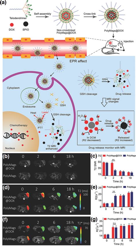 Theranostic liposomes for cancer diagnosis and treatment: …