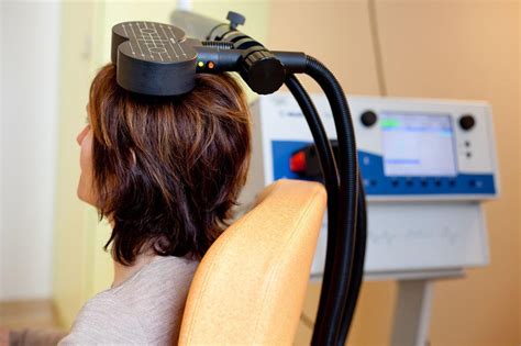 Theta-burst stimulation of TMS treatment for anxiety and …