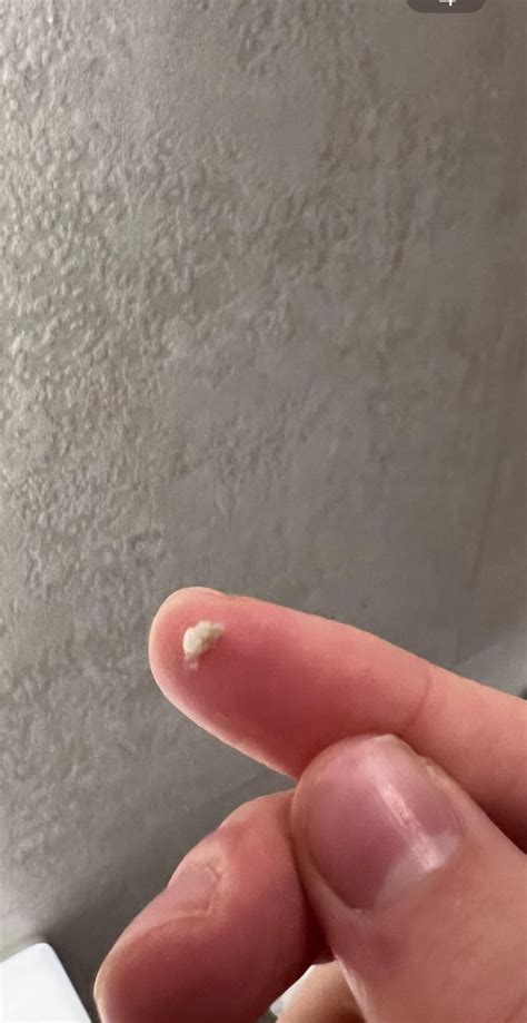 Thick Gluelike Mucus & Nasal Congestion for Years r/Sinusitis