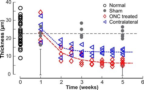 Thinning of the RNFL after ONC. Each symbol: the average RNFL …