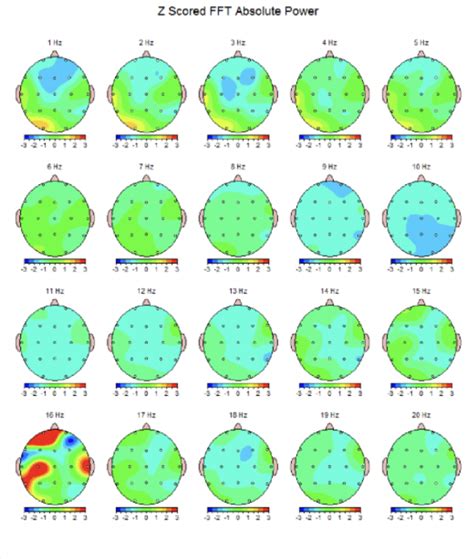 This “concussion recovery program” is