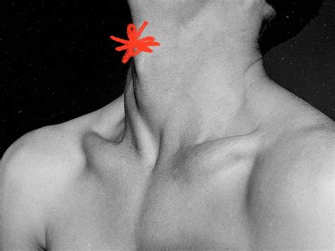 Throat contusion What to know